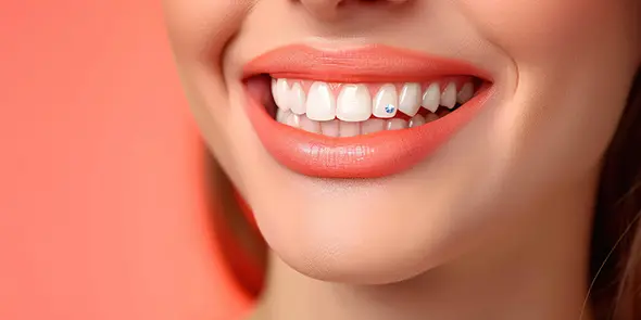 ティースジュエリー