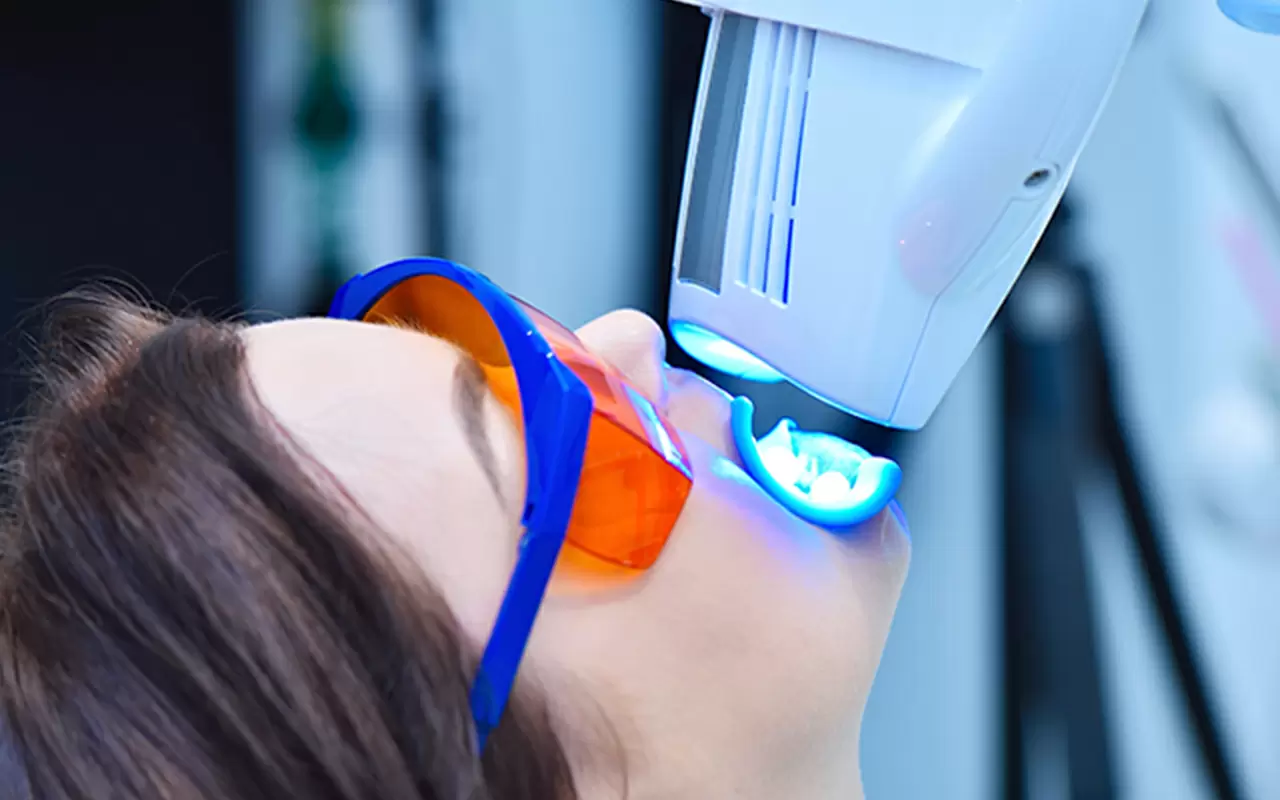 オフィスホワイトニング